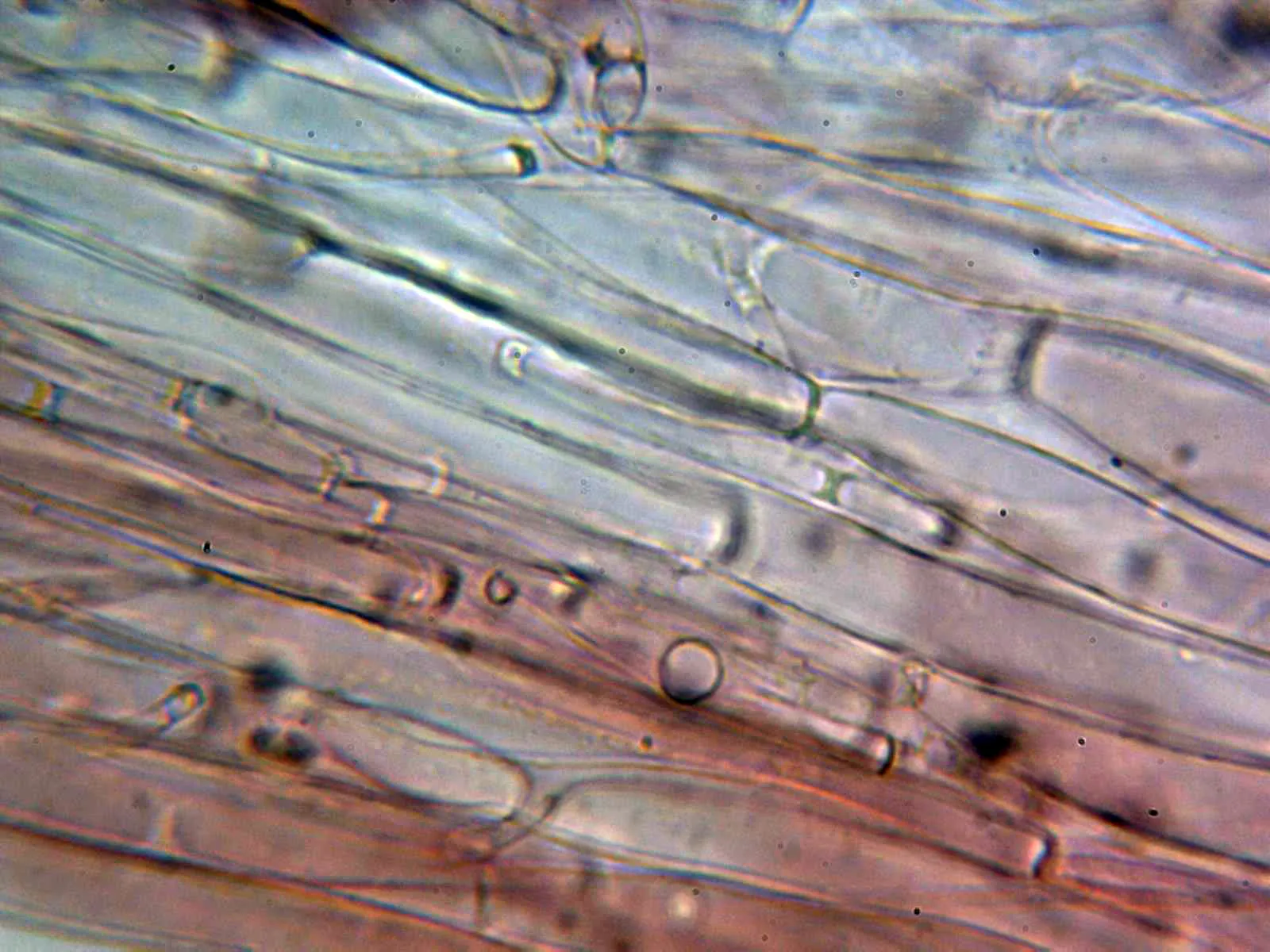 Microscopía de Rickenella fibula - 11 - Pileipellis con diminutas fíbulas